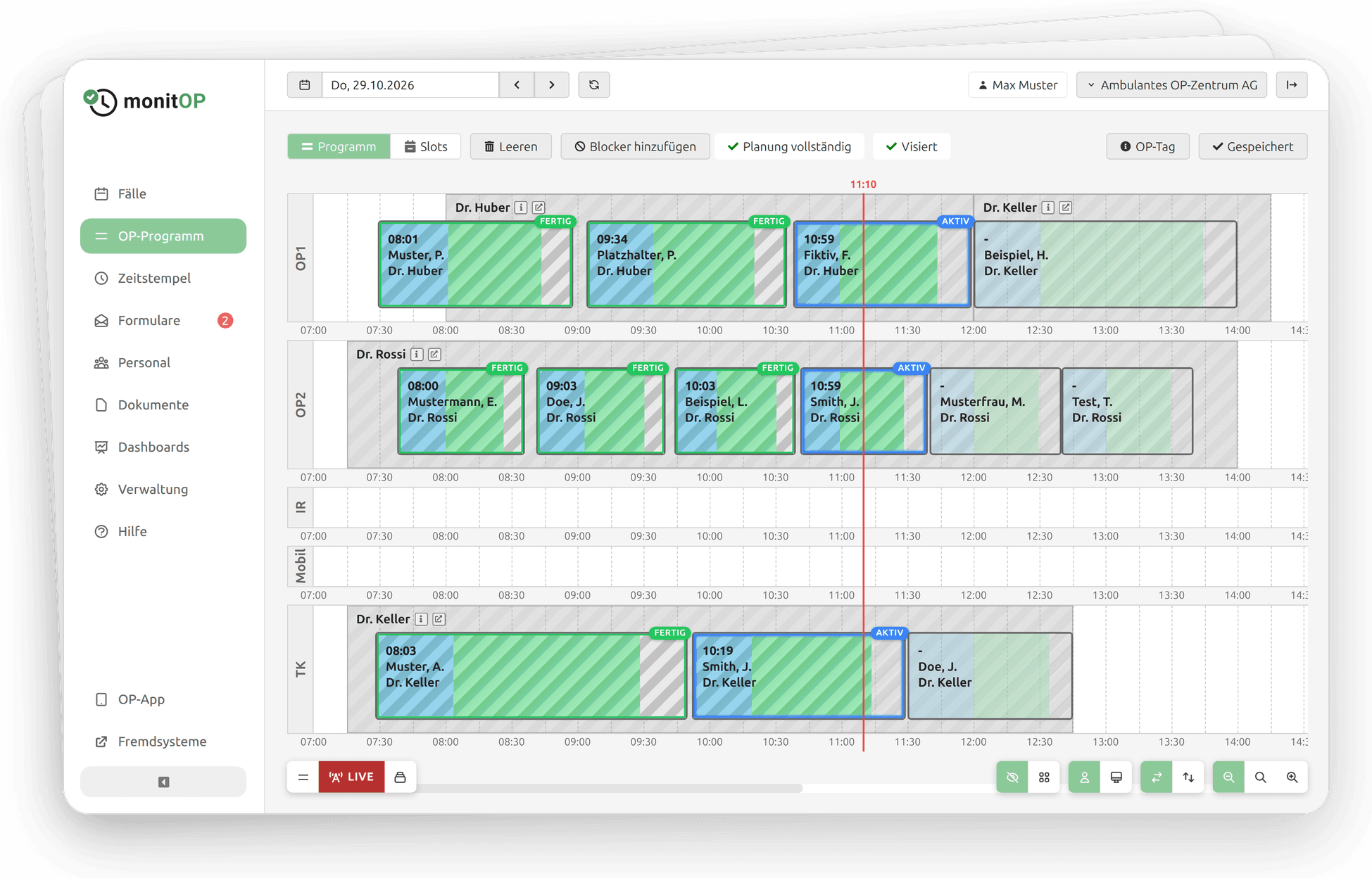 OP-Programm in der Applikation MonitOP